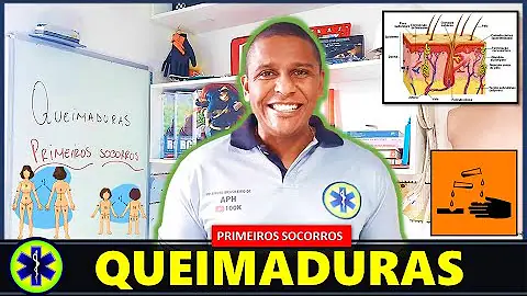Como proceder em caso de queimadura Quimíca?