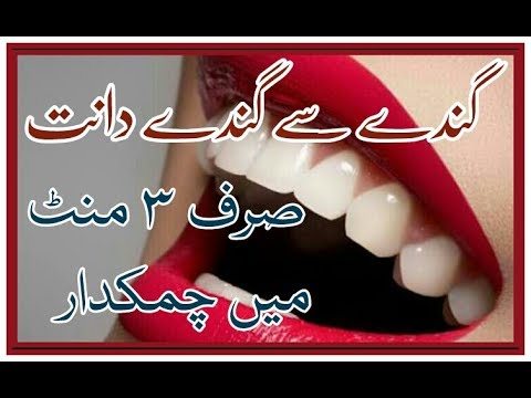 Whiten Your Teeth Within 3 Minutes | Urdu Hindi | Lemon + Baking Soda + Banana Peel | Beauty Tips |