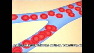 Hirudoid Forte-Mainos