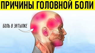 Головная Боль в Затылке | Почему болит голова в области затылка Что делать если болит голова?