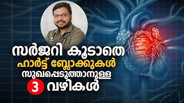 സർജറി കൂടാതെ ഹാർട്ട് ബ്ലോക്കുകൾ സുഖപ്പെടുത്താനുള്ള 3 വഴികൾ Heart Block Treatment without Angioplasty