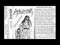 Amputation - Death Is Not The End