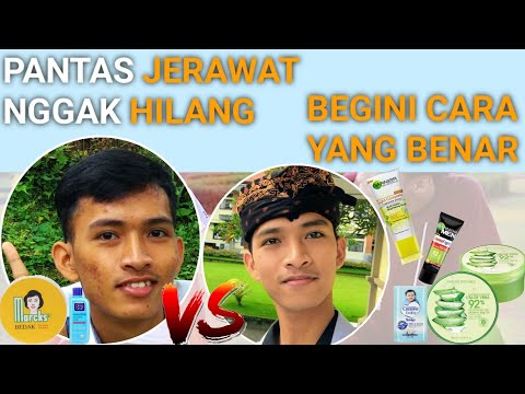 CARAKU MENGHILANGKAN JERAWAT!. 