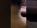 Cervical kaise thik Kare shikhe #Physiotherapy & #acupressure dawara
