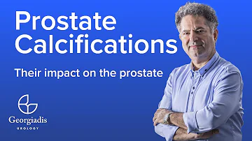 Are prostate calcifications normal?
