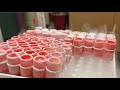 Making Stem Cells from Skin | Leah Foltz | TEDxSantaBarbara