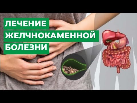 Лечение желчнокаменной болезни