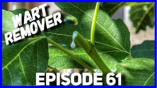 How to Kill Warts Naturally Fast - Wart Removal - Fig Latex (Ep. 61)