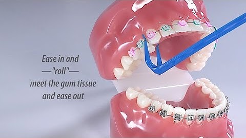 How to floss with the HARP