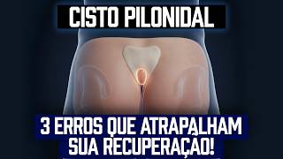 Cisto Pilonidal: Cuidados Essenciais no Pós-Operatório e Como Evitar Recidivas