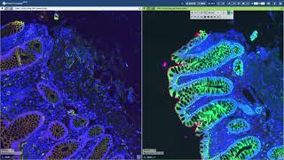 OMERO Plus, Bio-Formats and PathViewer Release - Jade