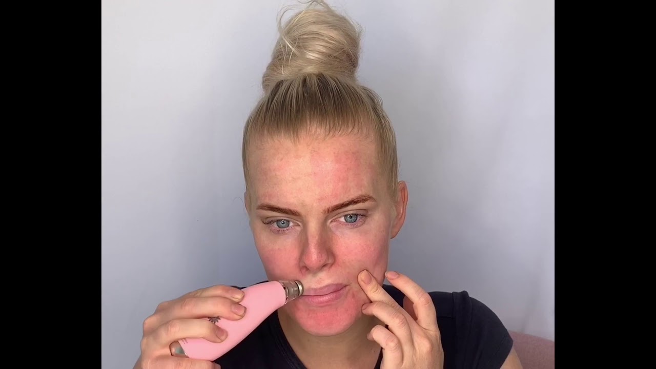 Microdermabrasion tutorial YouTube