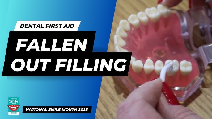 What to do when you lose a filling, how to use temporary dental filling  material. 