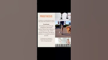 Advance Prosthesis || Prosthetic Limb #prime_care_rehabs  #artificiallimb #advance #prosthetics