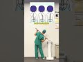A stick corrects scoliosis#Scoliosis#Adolescent scoliosis#Scoliosis in children#Spinal