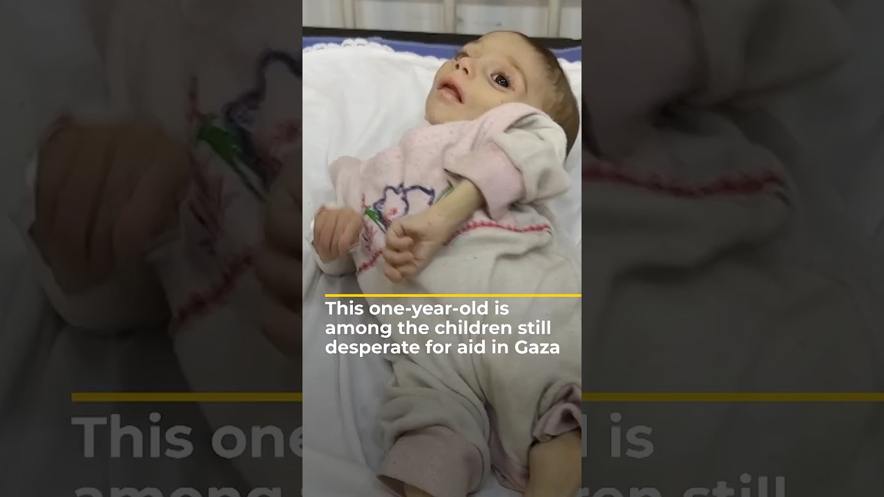هذا الطفل البالغ من العمر عامًا واحدًا هو من بين الأطفال الذين ما زالوا في أمس الحاجة إلى المساعدة في غزة