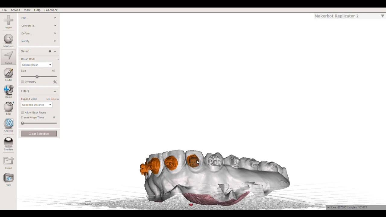 Debonding and removing orthodontic brackets in Meshmixer YouTube