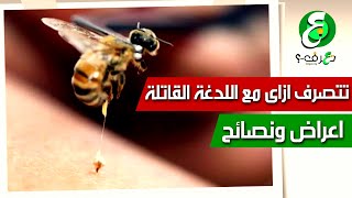 لسعة الدبور | ٤ نصائح تنقذ حياتك بعد لدغة الدبور - النحلة | فيديو ٢٠٢٢