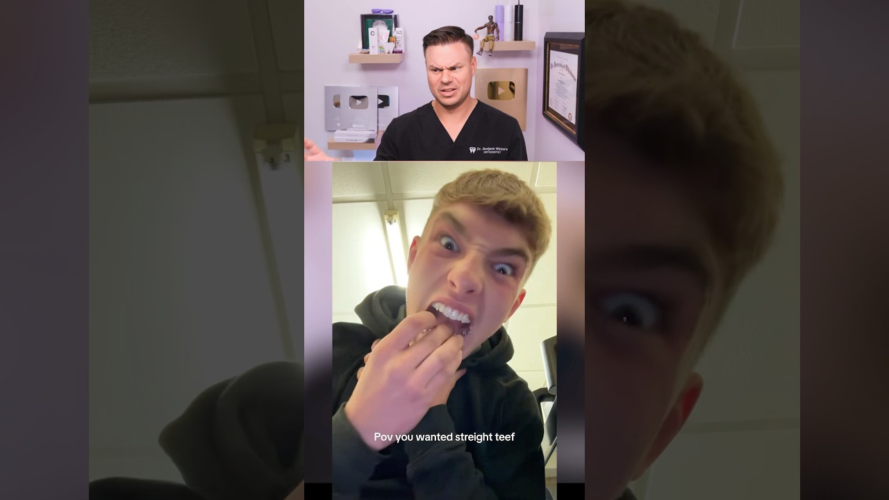 POV You Wanted Straight Teeth! 😂🦷