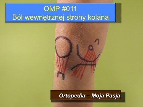 Co boli w kolanie po stronie przyśrodkowej? | OMP#011