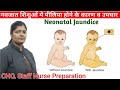 Physiological Neonatal jaundice with causes, types & treatment in hindi || level of bilirubin