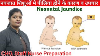 Physiological Neonatal jaundice with causes, types & treatment in hindi || level of bilirubin