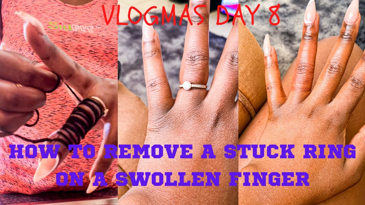 Removing Ring Stuck on Swollen Finger | TikTok
