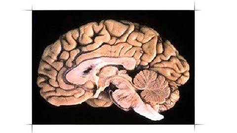 Nervous system 2 of 7 Brain, nerves and reflex actions/arcs