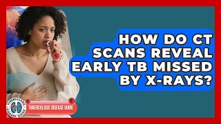 How Do CT Scans Reveal Early TB Missed By X-rays? - Tuberculosis Disease Guide