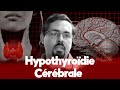 Hypothyrodie crbrale dcouverte de ses liens avec les troubles neurodgnratifs et de lhumeur