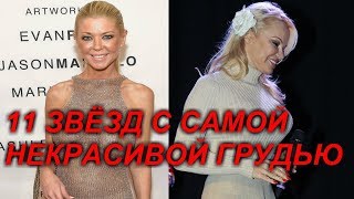 Размер не имеет значения: 11 звезд с самой некрасивой грудью Размер не имеет значения: 11 звезд с самой некрасивой грудью