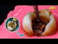 AMAZING Root Canal Treatment Process in 4k!