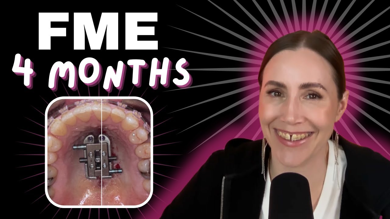 4 месяца FME: мой удивительный опыт асимметричного расширения!