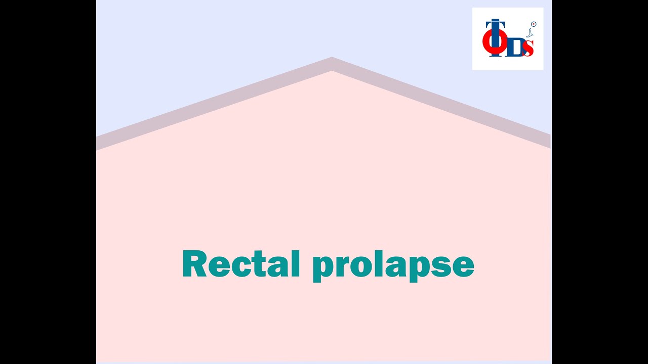 Rectal Prolapse | Dr Tulip JP Nagar