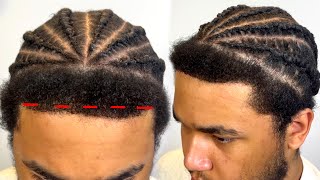 there’s nothing wrong with his hairline i’m just over exaggerating