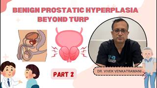 BPH Treatment Beyond TURP: Medicines, Laser &amp; Advanced Surgery Options (Part 2) | Dr. Vivek Venkat