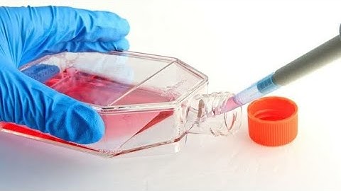 Hybridoma technology- Explanation in English