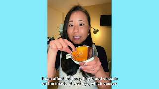 #AskAnEyeDoc Dr. Chinn Discusses How Eye Exams Detect Hypertension