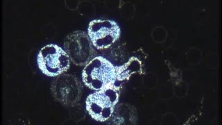 Can I Use My Own Microscope for the Course? - Live Blood Analysis Training Course