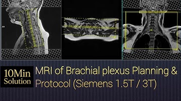 How to MRI of Brachial Plexus | MRI Brachial Plexus Planning & Positioning Tutorial