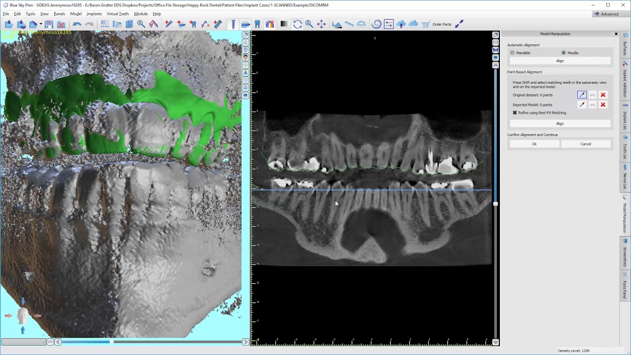 BSP Guide Delegation - Part 1: Case Setup
