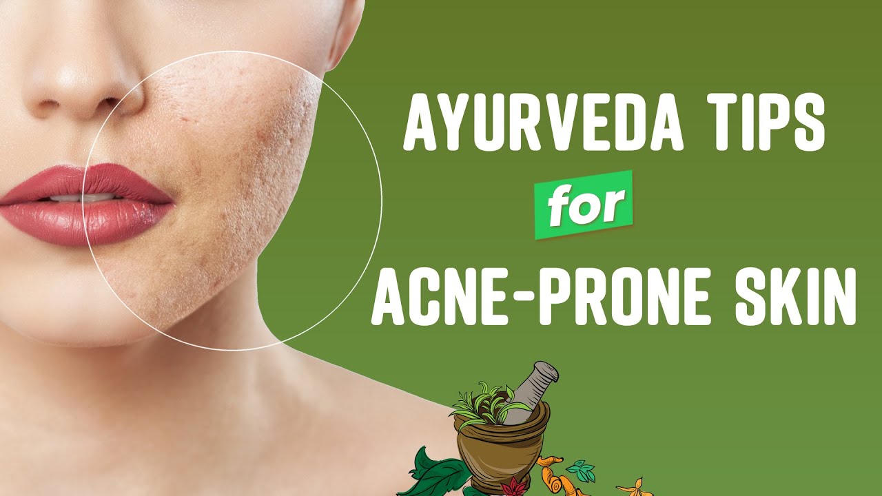 Ayurveda tips for acneprone skin Expert tips on Acne prone skin by