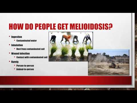 Vídeo: Uma Nova Infecção Mortal Emerge Dos Trópicos - Melioidose - Visão Alternativa