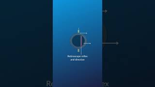 Types of retinoscopy reflex #retinoscopy #optometry #eyeexam #optomyze #shorts