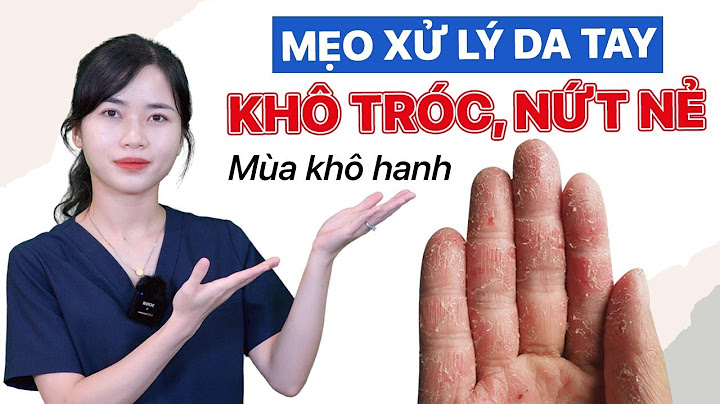 Bị khô da tay là thiếu chất gì năm 2024