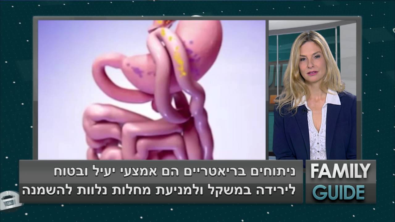 ניתוח בריאטרי: על ניתוחים לטיפול בהשמנת יתר עם ד