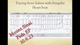 Mount Sinai Pediatric EP Conference 10.9.23