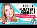 Do You Have Eye FLoaters? | Are Eye Floaters Normal? | An Eye Doctor Explains