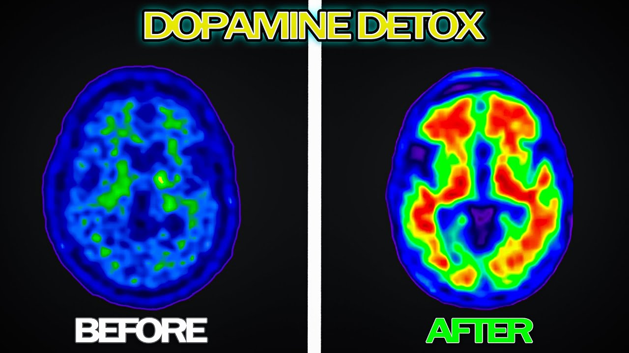 DOPAMINE DETOX - COMPLETE Guide + The Actual Science - YouTube
