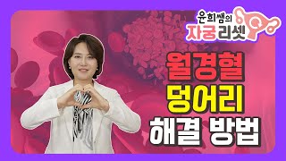 [구독자 5만 Hit] 월경 덩어리혈 해결 방법 대공개